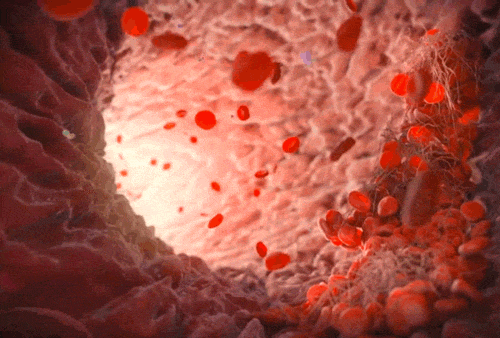 15.gif